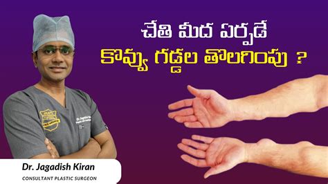 Lipoma Treatment In Hyderabad Multiple Lipoma Removal From Hand