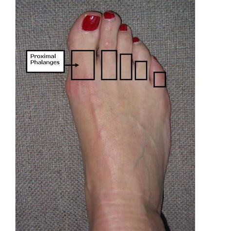 How To Know If Your Big Toe Is Broken