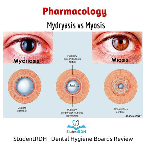 Q The Following Drugs Cause Pupil Dilation Except Studentrdh Blog