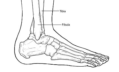 Download the free graphic resources in the form of png, eps. Ankle Fractures - Foot Health Facts - Foot Health Facts