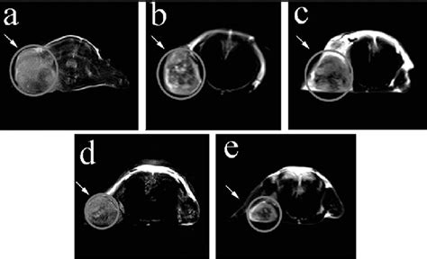 T2 Weighted Fast Spin Echo Images After Injection Of 25 Mg Ml À1 Download Scientific Diagram