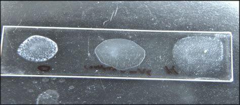 Food is the source for most of these illnesses. Salmonella slide agglutination test showed agglutination ...