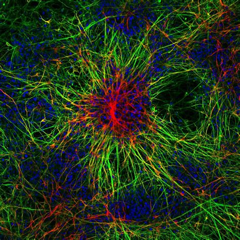 Human Skin Cells Reprogrammed And Differentiated Into Neurons Nikons