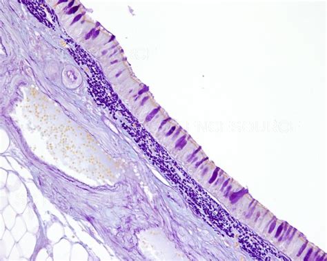 Photograph Tracheal Mucosa Gabe Technique LM Science Source Images