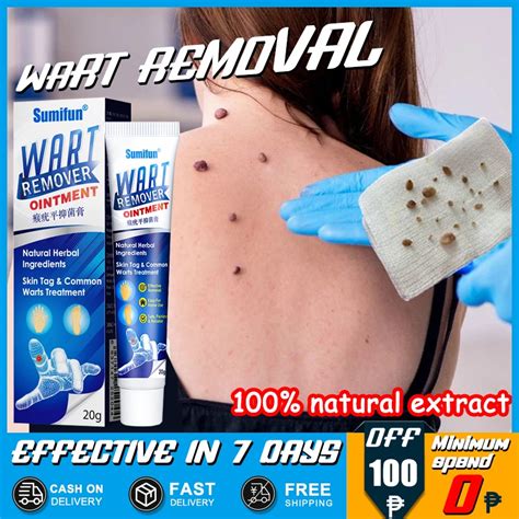 warts remover original cream wart removal ointment wart treatment skin tags mole remover cream