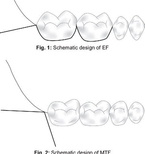 Figure 1 From Comparison Of Envelope And Modified Triangular Flaps On