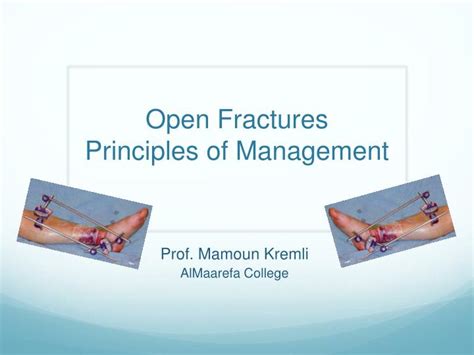 Ppt Open Fractures Principles Of Management Powerpoint Presentation
