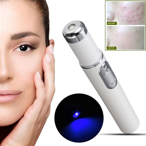 Severe cases may need medication taken by mouth or in an injection. Pin on Neutrogena Acne Mask Light Therapy
