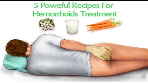 Hemorrhoids Home Treatment Relief Recipes YouTube