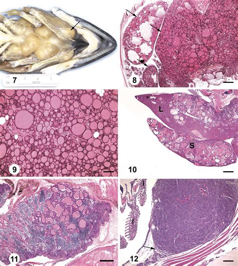 —nodular Follicular Cell Hyperplasia In A Rainbow Trout O Mykiss Download Scientific