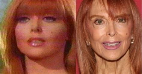 Tina Louise Plastic Surgery Facelift Celebrityfreeze Com Tina