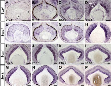 Expression Profiles Of Sox4 And Sox11 During Retinogenesis Wild Type Download Scientific