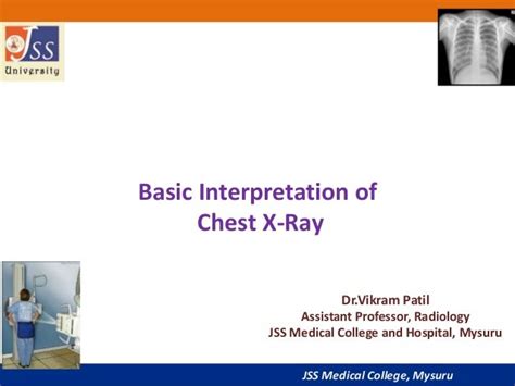 Chest X Ray Basic Interpretation