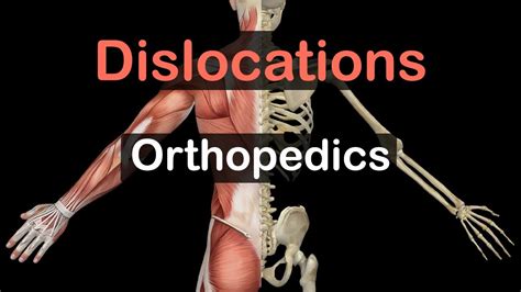 Orthopedics Dislocations Youtube