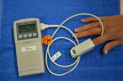 53 Pulse Oximetry Clinical Procedures For Safer Patient Care