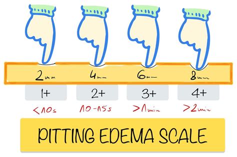 Pitting Edema Scale