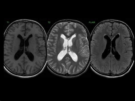 Mri Basics How To Read And Understand Mri Sequences