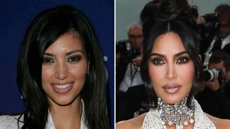 Kim Kardashian Before And After Plastic Surgery Timeline Life And Style