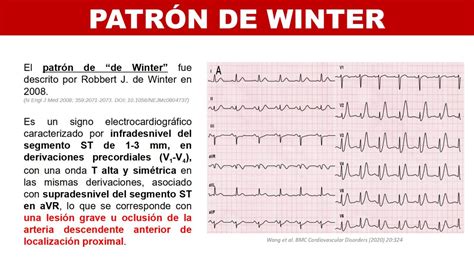 Cardiotruco Patrón De Winter Cardioprimaria Ferrol
