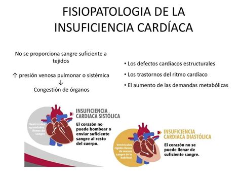 Fisiopatología de la insuficiencia cardiaca Vian uDocz