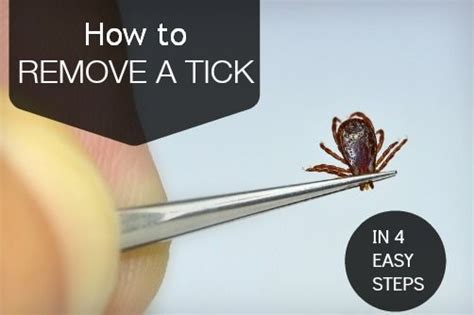 How To Remove A Tick In 4 Easy Steps Aufirst Aid