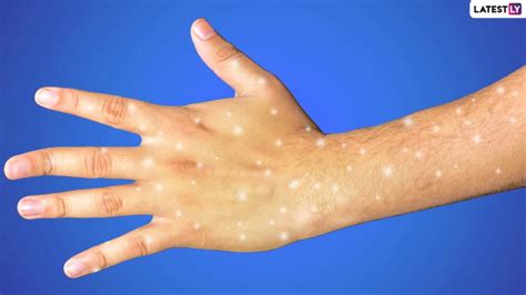 White Spots On Arm Skin