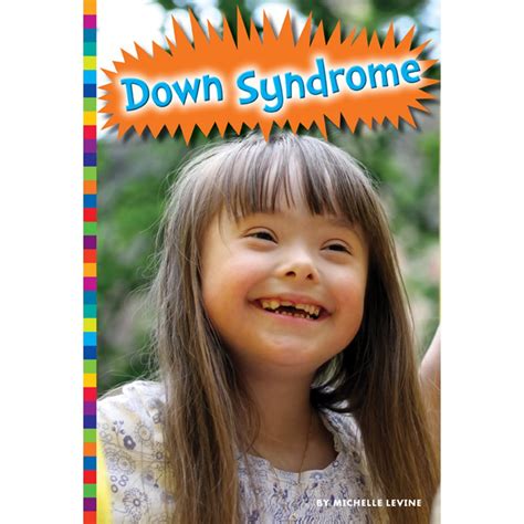 Living With Down Syndrome Hardcover