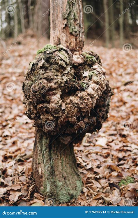 Burr On A Tree Trunk Stock Photo Image Of Wooden Trees 176292214