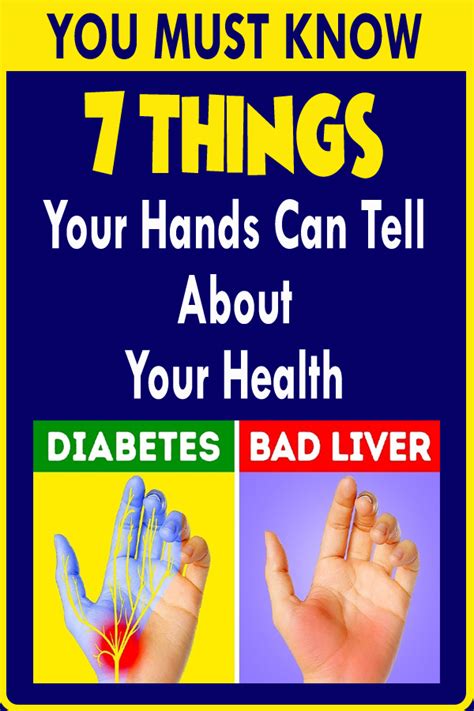 7 Things Your Hands Can Tell About Your Health