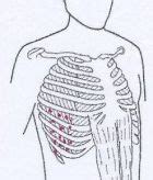 Schmerzen Im Brustkorb Ursachen Und Behandlung Verspannungen L Sen