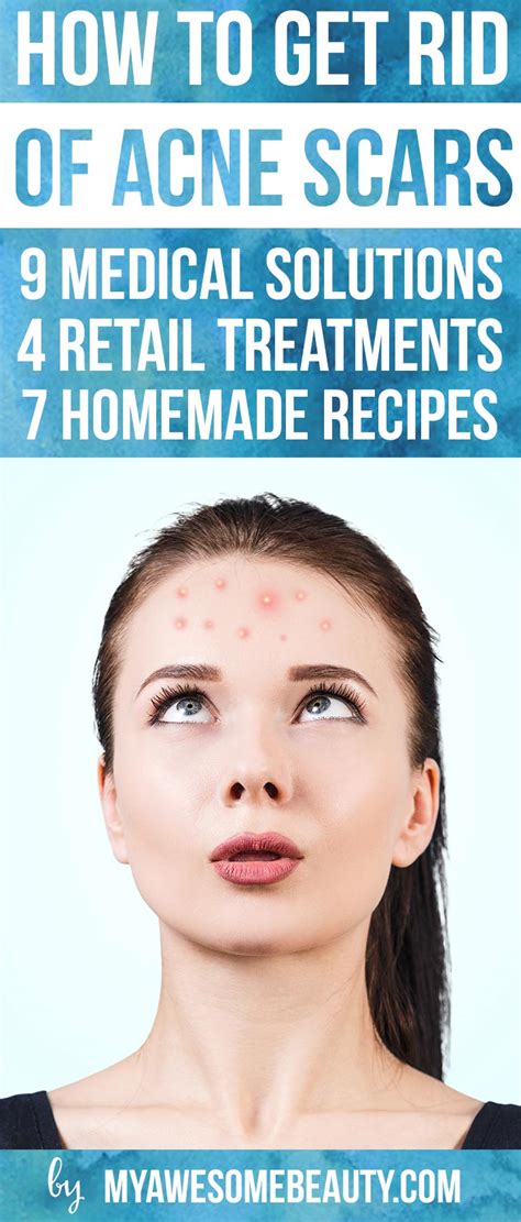 How To Get Rid Of Acne Scars Fast The Best Treatments And Tips