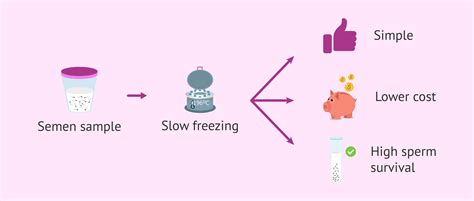 Advantages Of Cryopreservation Of Sperm By Freezing