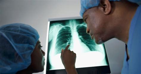 What can cause rib cage pain? Pain Under Right Rib Cage: 26 Common Causes, Diagnosis and ...