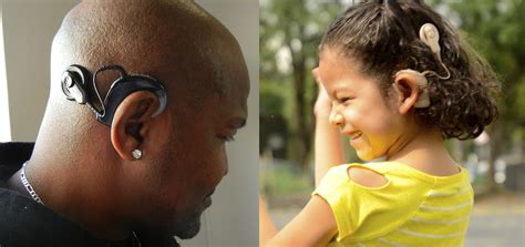 Your Concerns About Cochlear Implants Answered — Hearing Health Foundation