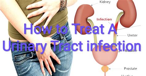 Healthcare And Health Solution How To Treat A Urinary Tract Infection