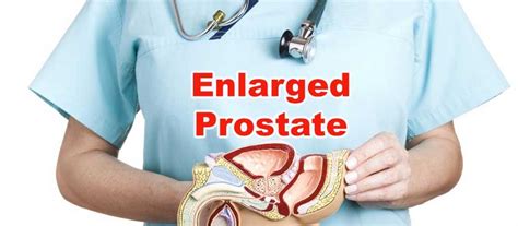 HealthcareTurkey Prostate Enlargement Treatment Is It Useful