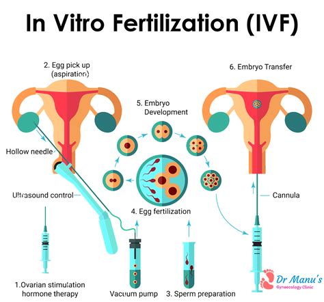 best hospital for ivf treatment chennai archives best gynecology speciality hospital in