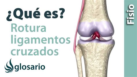 rotura de los ligamentos cruzados ¿qué es youtube