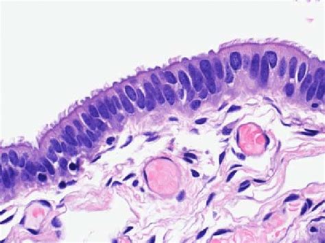 Histologic Image Of A Normal Fallopian Tube Featuring Pseudostratified