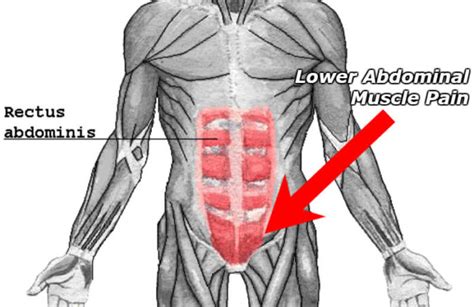 What Does A Pulled Lower Abdominal Muscle Feel Like Symptoms List