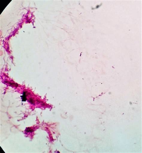 Gram Stain Gram Positive Branching Filamentous Bacteria Suggestive