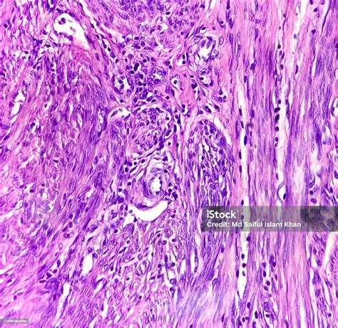 Slide Histologis Dari Sampel Jaringan Tutup Pandangan Mikroskopis