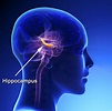Acupuncture Alzheimer’s Disease Brain Protection Found