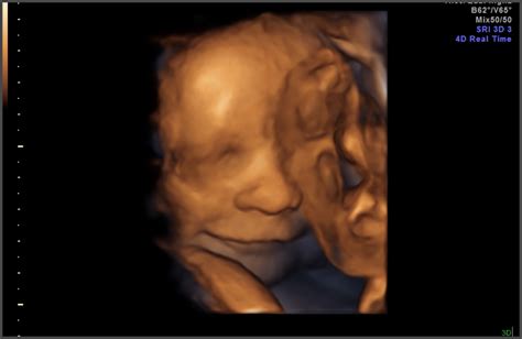 3d Images Of Baby At 33 Weeks The Meta Pictures