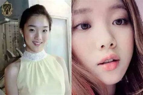 Lee sung kyung when she was a kid. Lee Sung Kyung plastic surgery: Eyelid Surgery, Nose job