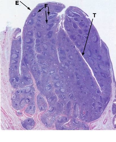 Pharyngeal Tonsil Histology