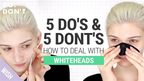 10 Must Know Tips If You Struggle With Whiteheads How To Effectively