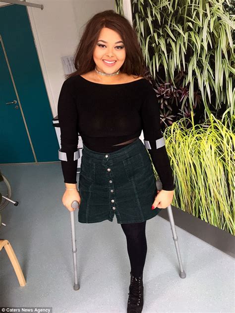 Teen With Incurable Bone Cancer Ditches Her Prosthetic Leg Daily Mail