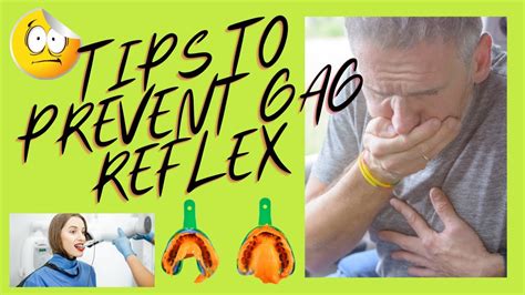 How To Manage Severe Gag Reflex During Dental Appointments Youtube