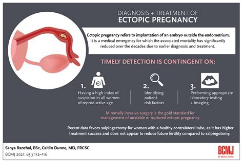 Diagnosis And Treatment Of Ectopic Pregnancy British Columbia Medical Journal